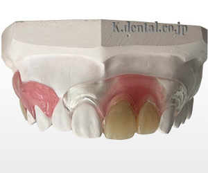 クリアクラスプサンプルの症例