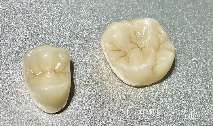 タムクラウン（製品詳細） – 歯科技工所｜Kdental