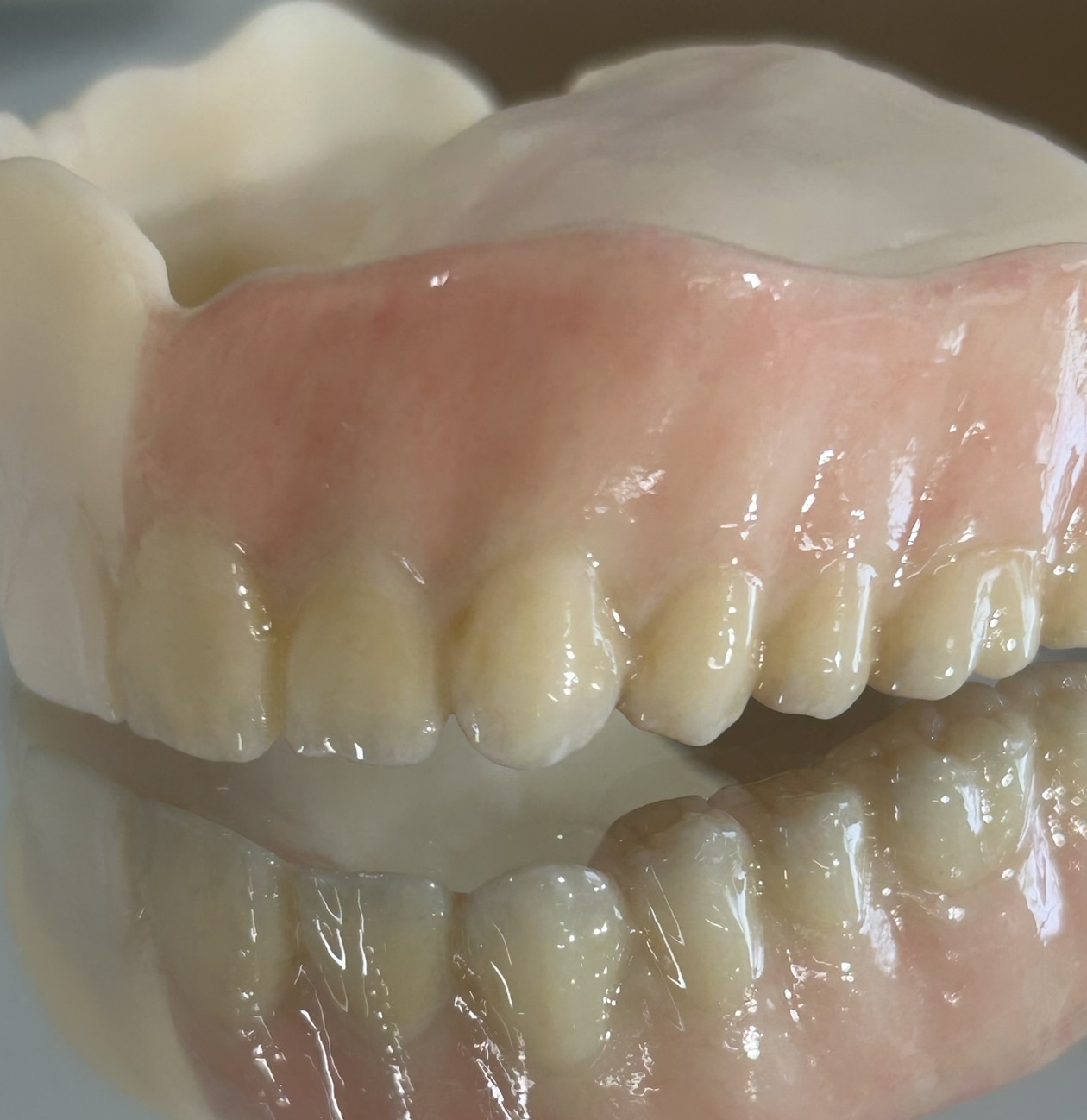 デジタルフルデンチャーCADCAMコピーデンチャーの作製 – 歯科技工所